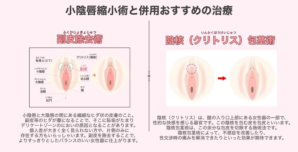 小陰唇縮小術と併用して行える婦人科形成
